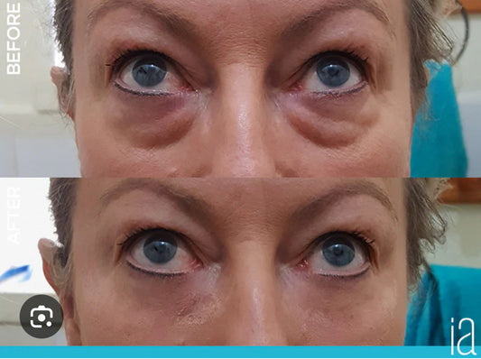 Instantly Ageless